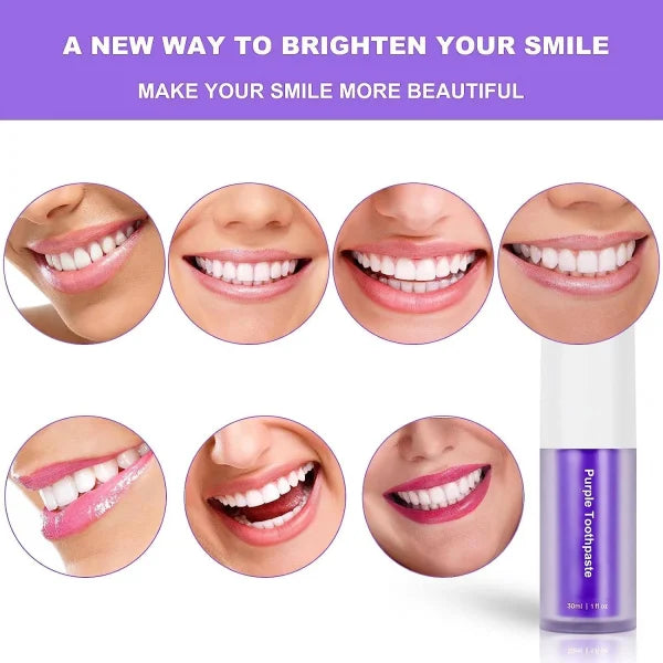 Teeth Brightening